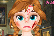 game Frozen Anna Face Problem